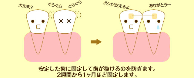 歯がグラグラする場合