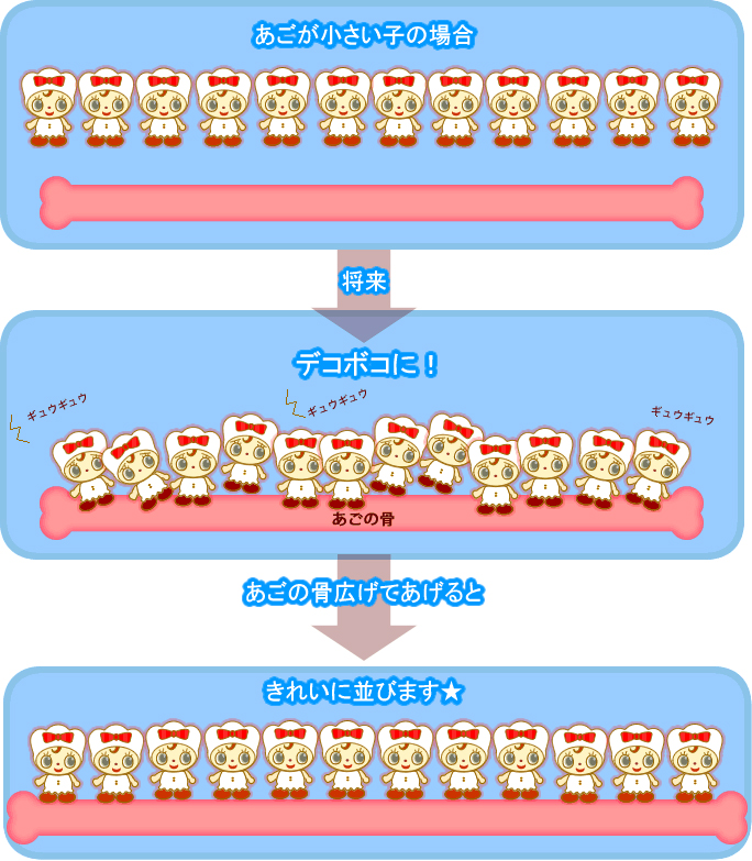 1期治療