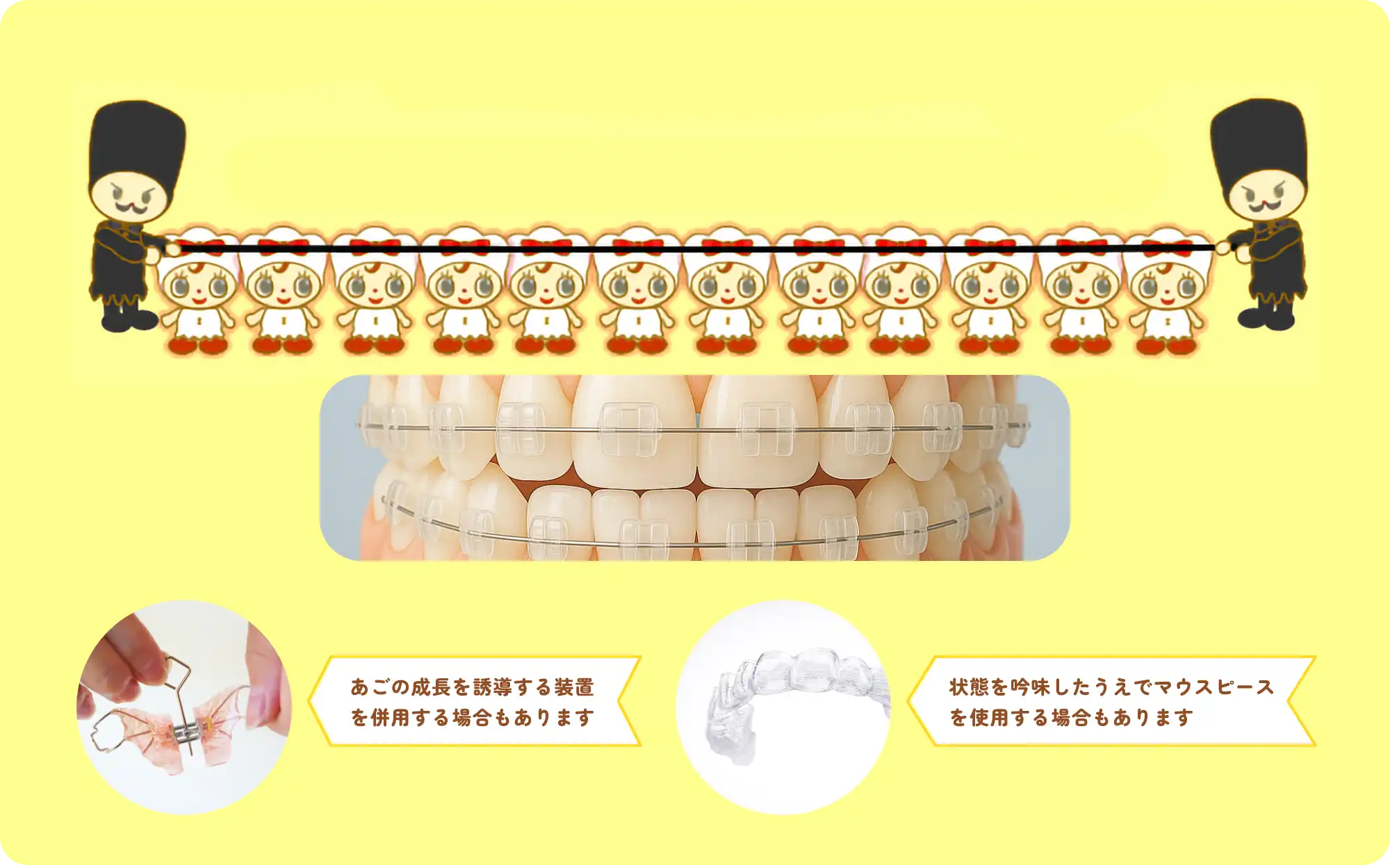 歯を3次元的に動かす
